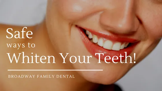 28121 teeth whitening ingredients