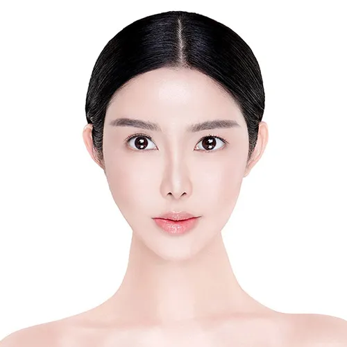 28123 vampire serum before after