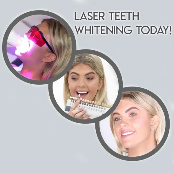 28131 teeth whitening types